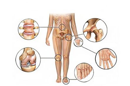 Types of arthrosis