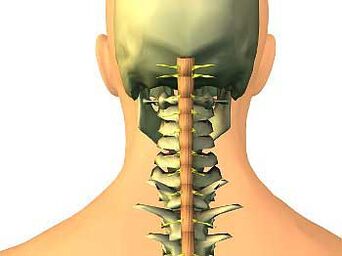 Osteochondrosis of the cervical region