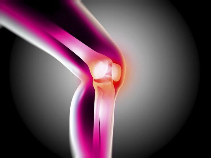 Arthrosis